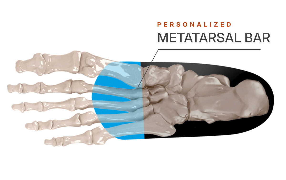 Personalized met bar