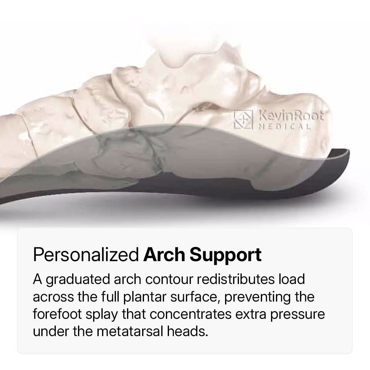Metatarsalgia, Morton’s Foot, Sneakers, MetaBalance™