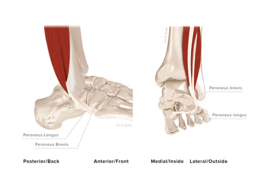 Peroneal Tendonitis