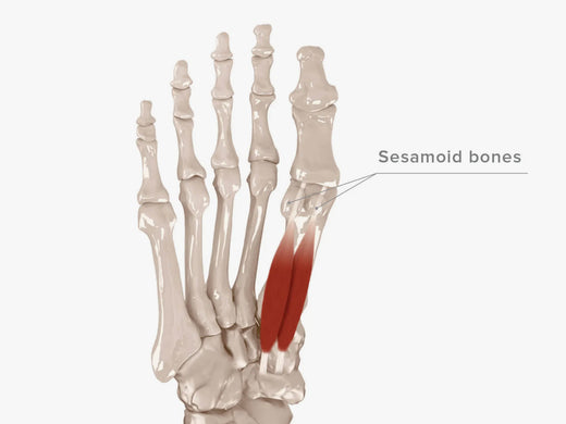 Sesamoiditis