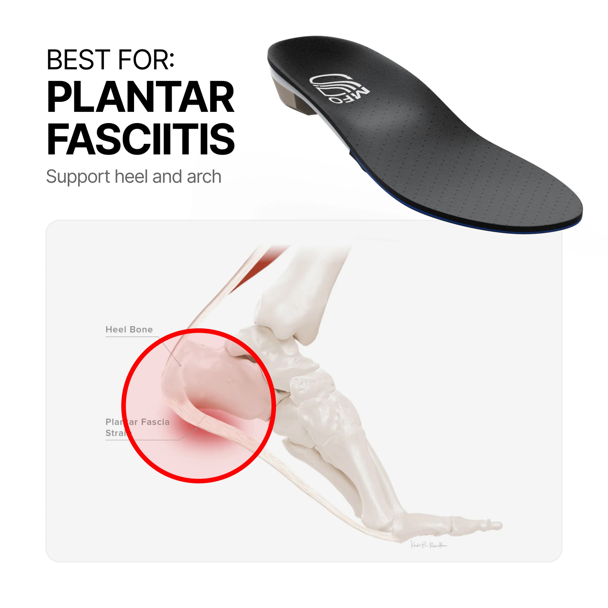 FasciaFloat™ [DEV 2]