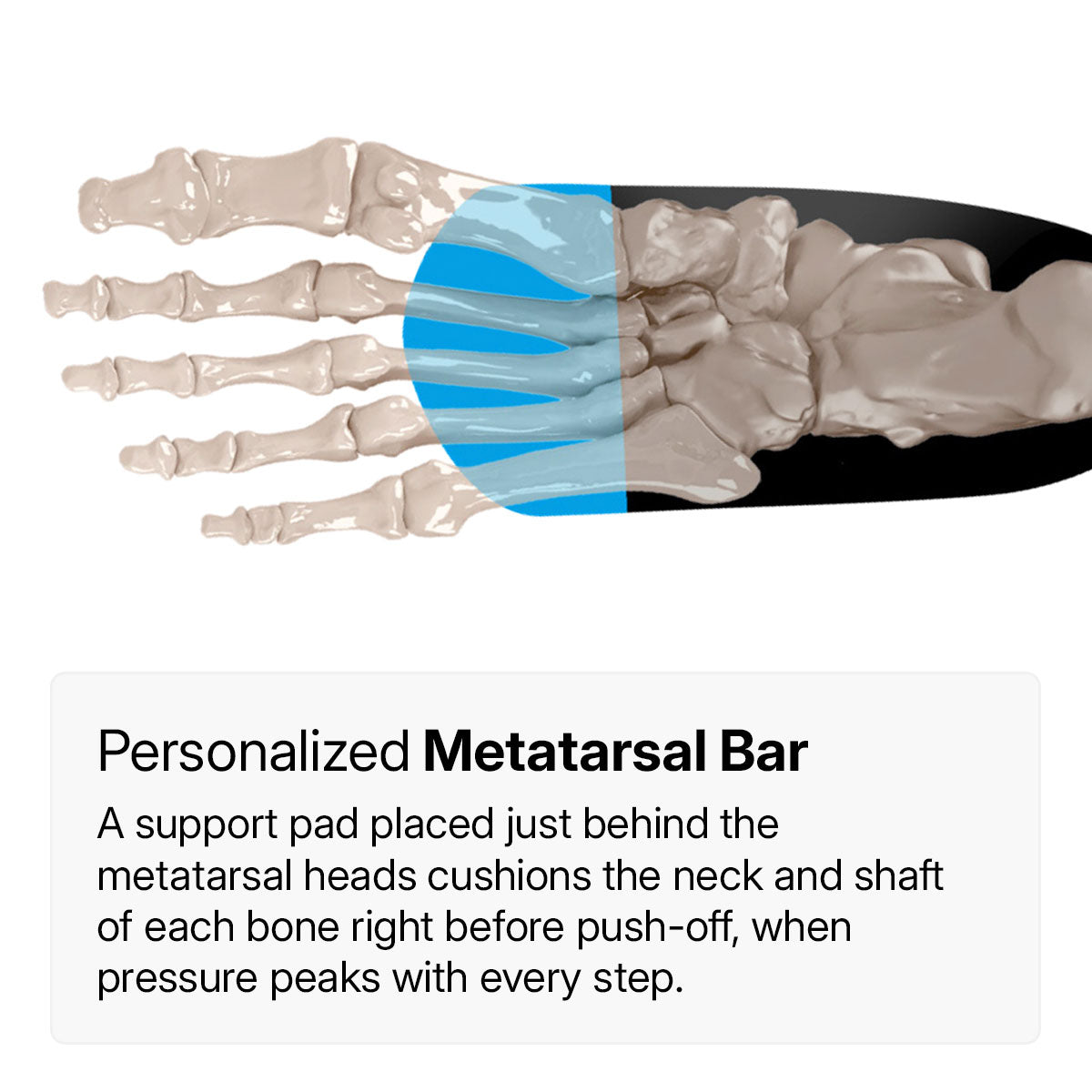 Metatarsalgia, Morton’s Foot, Sneakers, MetaBalance™