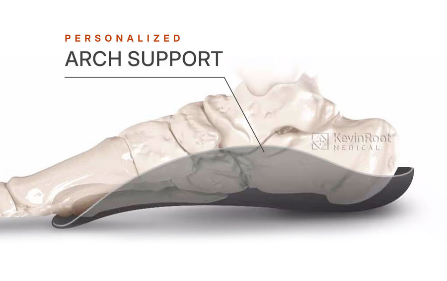 Personalized arch support
