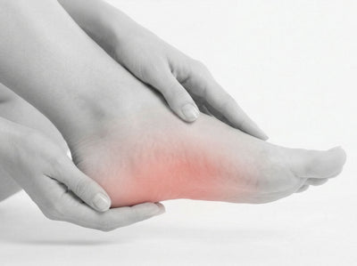 Flat foot and arch collapse
